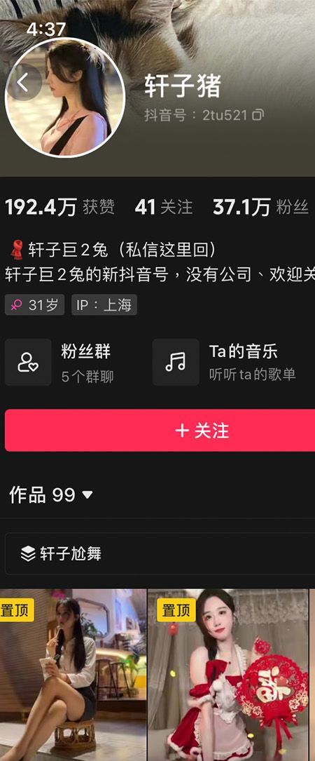 轩子巨二兔微密NO.004期【21P3V】插图