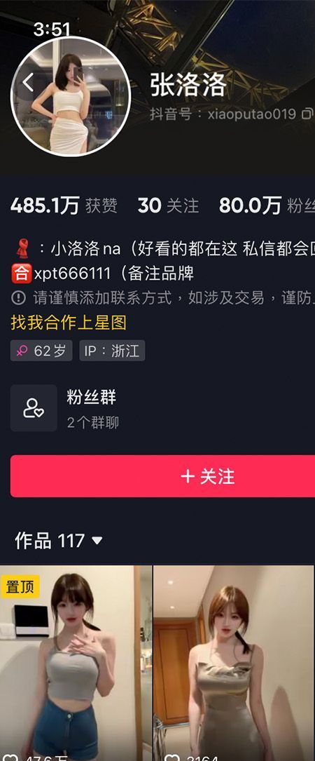 张洛洛微密NO.003期【31P3V】最新至：2023.6.28插图