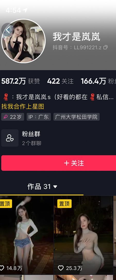 我才是岚岚微密NO.005期【5P2V】插图