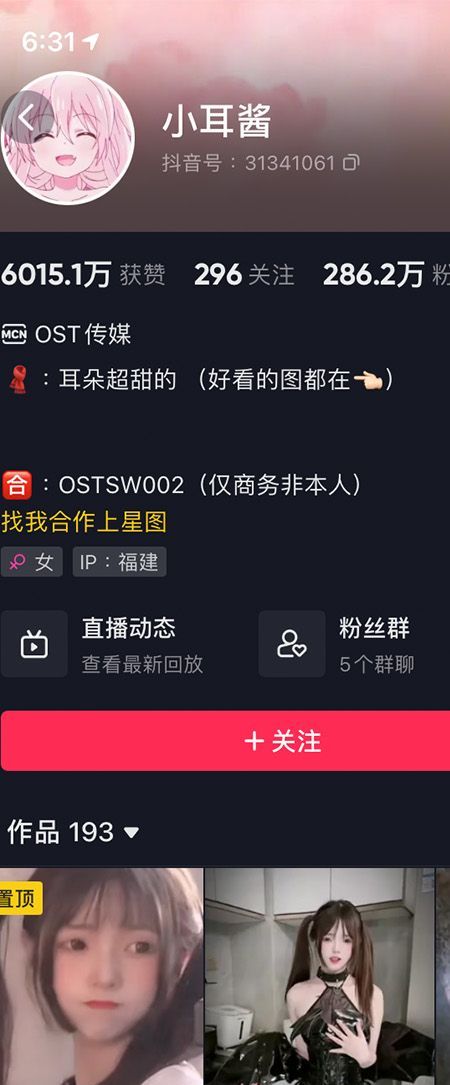 小耳酱微密NO.001期【52P】插图